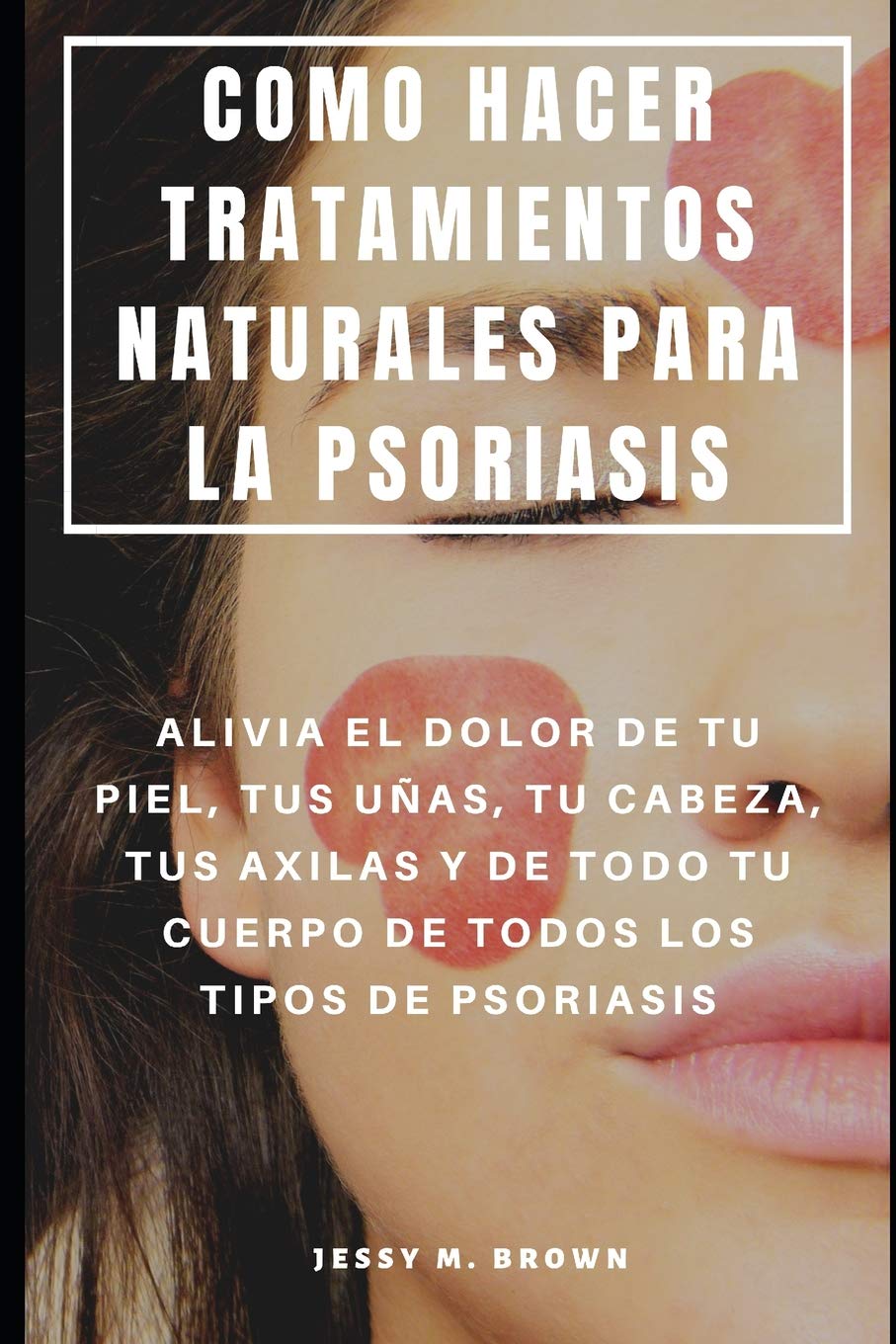 Tratamento Natural Da Psoríase - Aliv