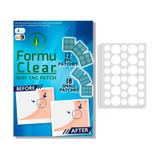 Adesivos Para Remover Marcas De Pele Patches Naturais 90 Adesivos