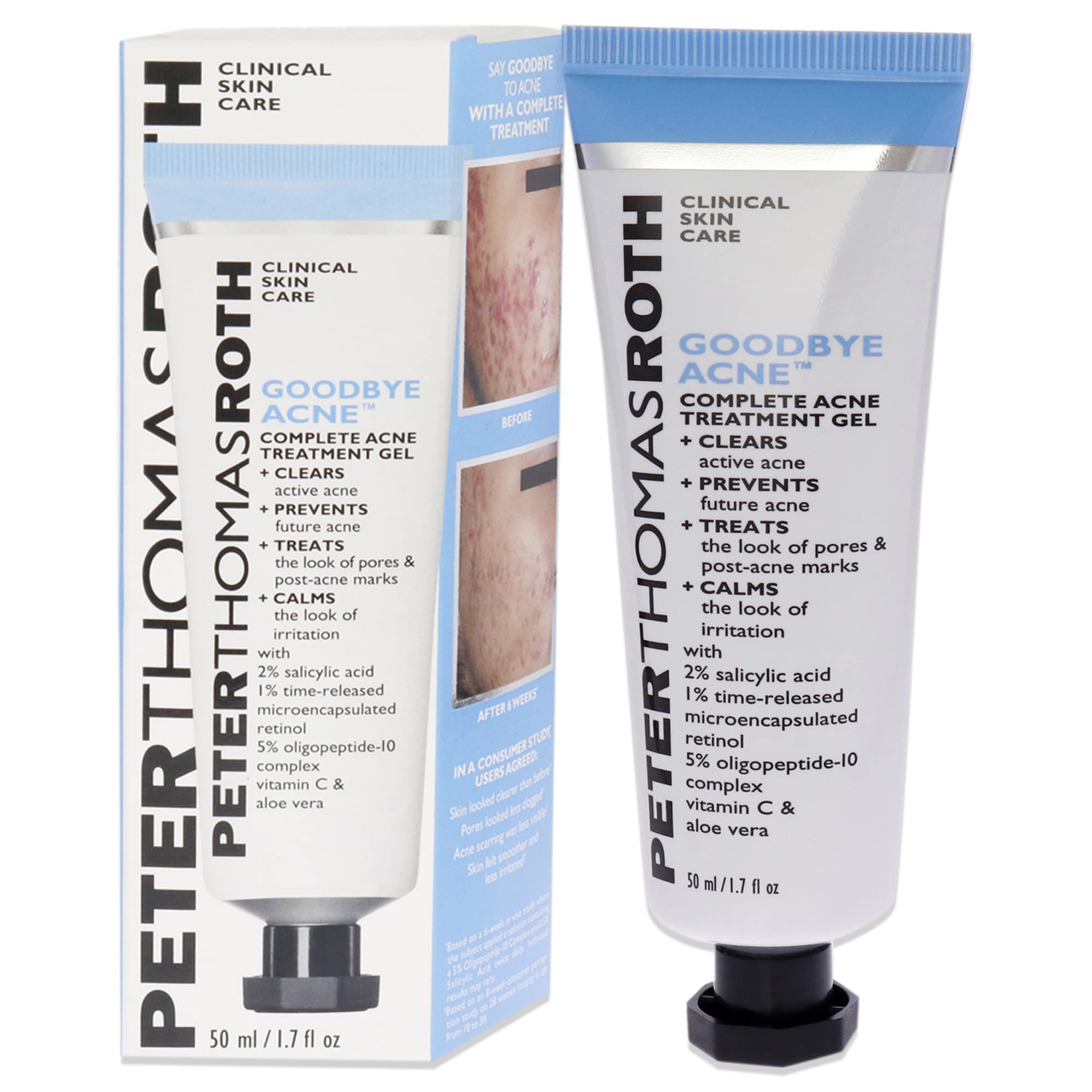 Gel De Tratamento Da Acne Peter Thomas Roth Goodbye Acne