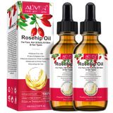 Óleo De Rosa Mosqueta Onznoz 60 Ml (pacote Com 2) 100% Puro Prensado A Frio