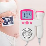Monitor Frequência Cardíaca Portátil Ideal Acompanhar O Bebê