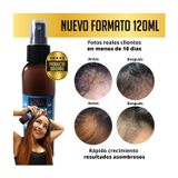 Spray De Crescimento Capilar Genérico Rápido E Eficaz 120 Ml