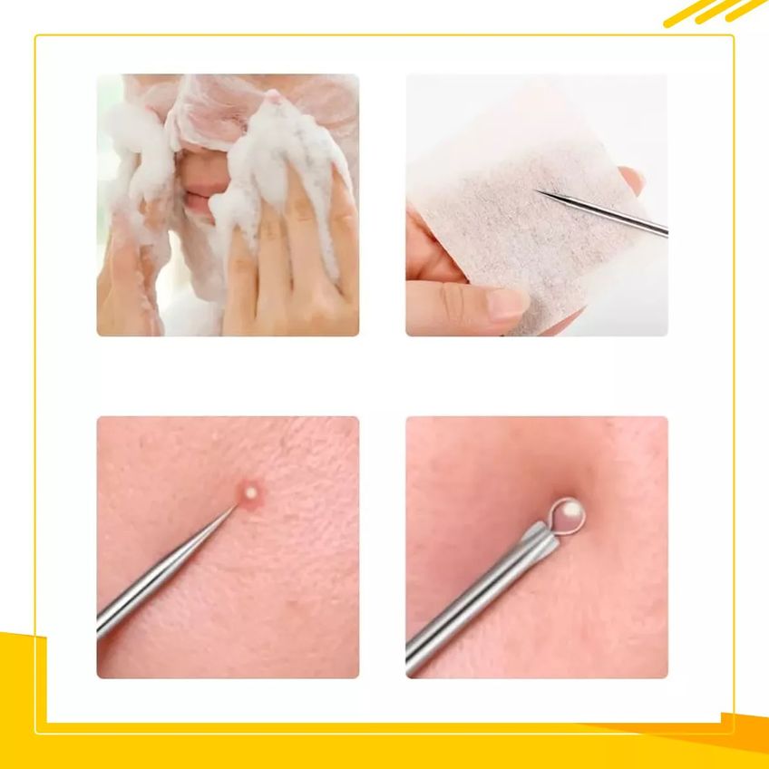 Kit 10 Pç Manicure E Pedicure Com Cortador De Unha, Alicate, Espatula, Cureta Aço Inox - imagem 4