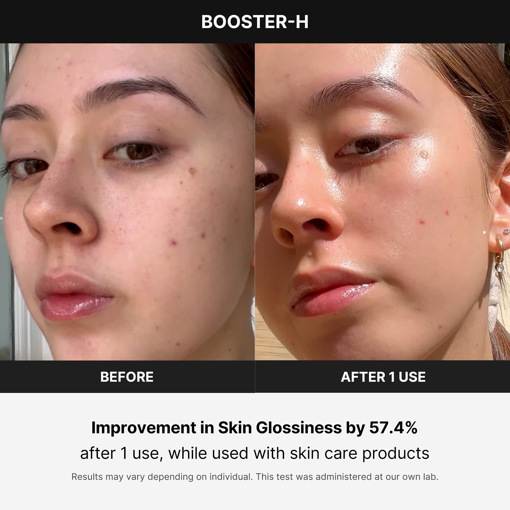 Dispositivo De Tratamento Facial Medicube Age-r Booster-h - Carrefour