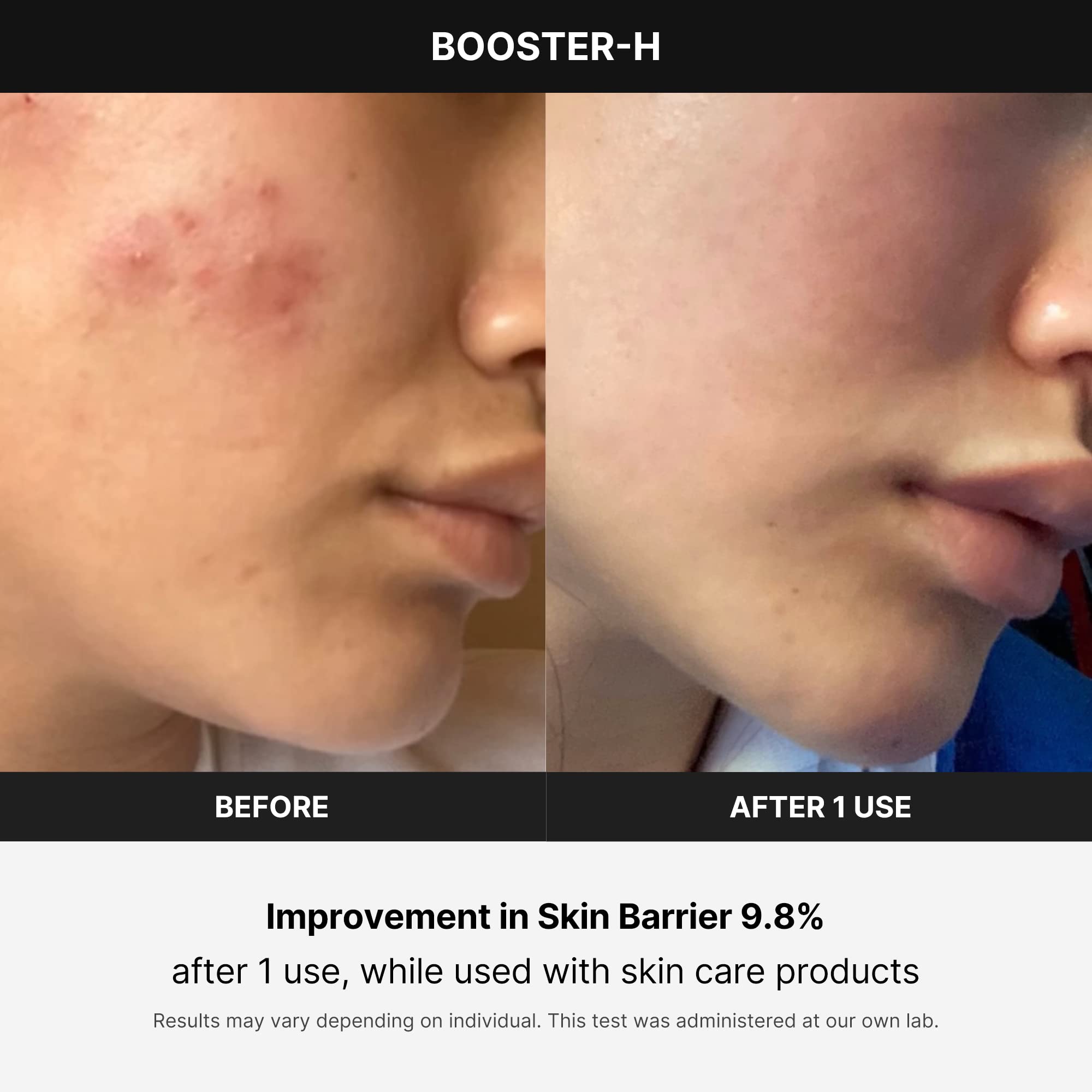 Dispositivo De Tratamento Facial Medicube Age-r Booster-h - Carrefour
