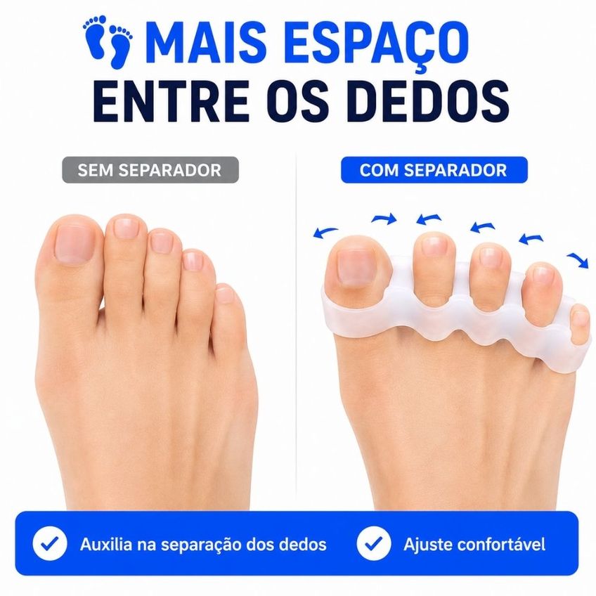 Par De Separadores De Dedos Em Gel De Silicone Macio E Confortável - imagem 2