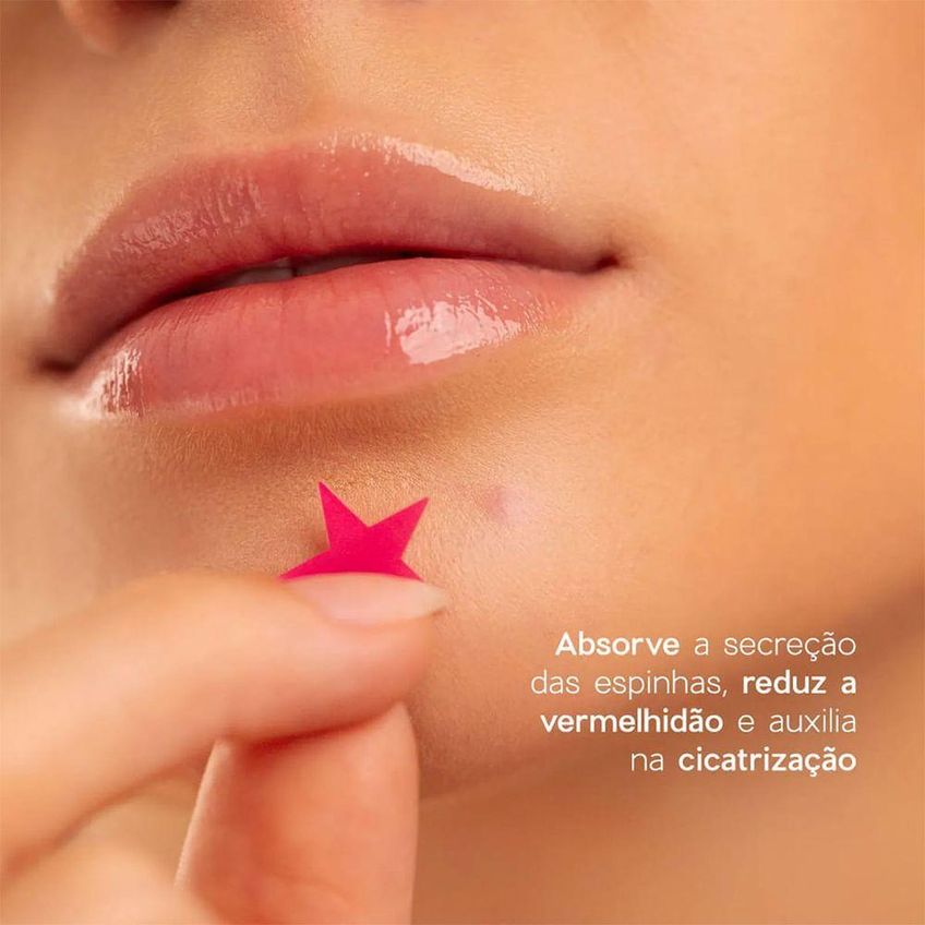 Adesivos Secativos Para Espinhas Star Acne Patches Oceane Tamanho Único - imagem 2