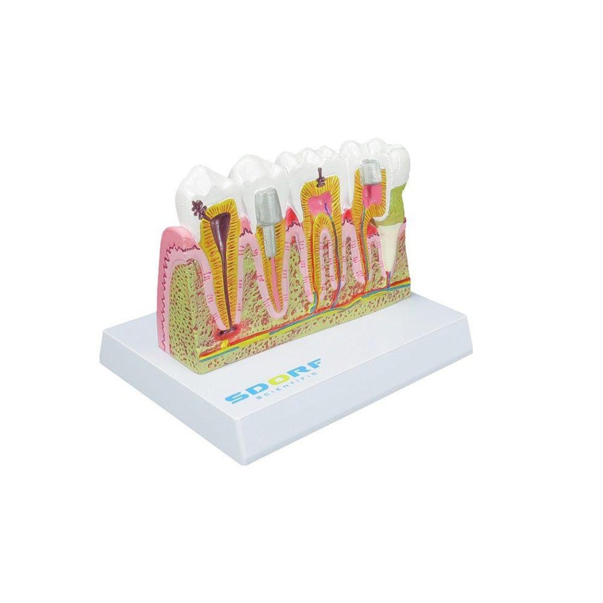 MP28131585_Modelo-de-Patologias-Dentarias_2_Zoom