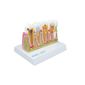 MP28131585_Modelo-de-Patologias-Dentarias_2_Zoom