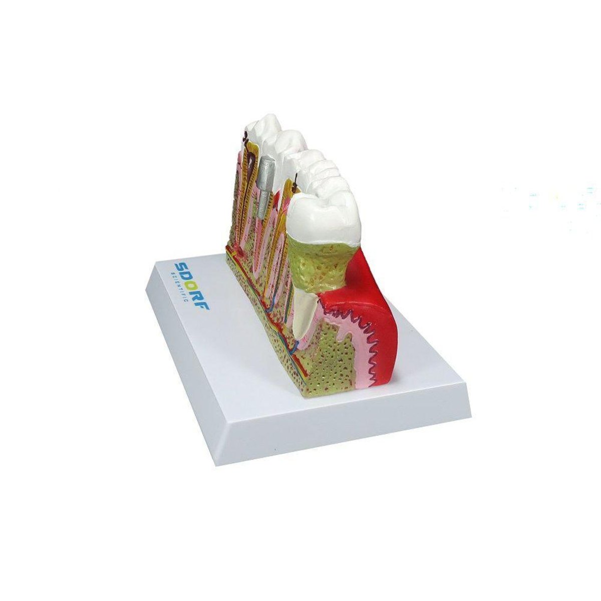 MP28131585_Modelo-de-Patologias-Dentarias_3_Zoom