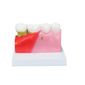 MP28131585_Modelo-de-Patologias-Dentarias_4_Zoom
