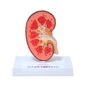 MP28069840_Rim-Humano-com-Patologias-Corte-Mediano-Modelo-Anatomia_1_Zoom
