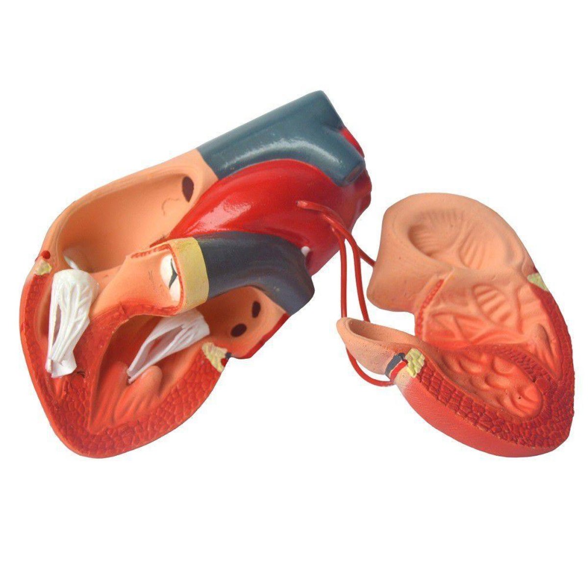 MP28013433_Coracao-Humano-Com-Pontagem-Coronaria_2_Zoom